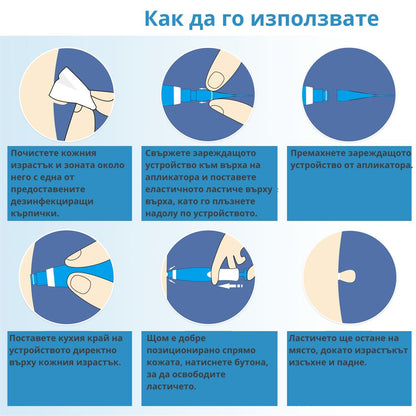 TagClean™ комплект за кожа – Премахнете кожните израстъци бързо и лесно.